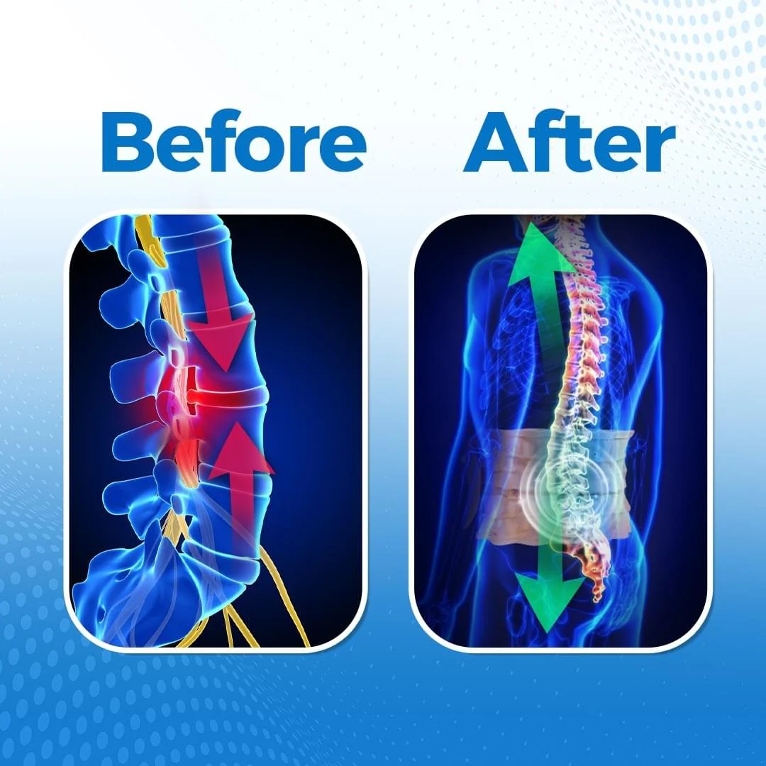 SuperRelief™ Lumbar Decompression Belt Al Aras Lab