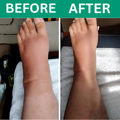 Oakwell™ 3-in-1 Leg Massager For Varicose Veins Hypersku