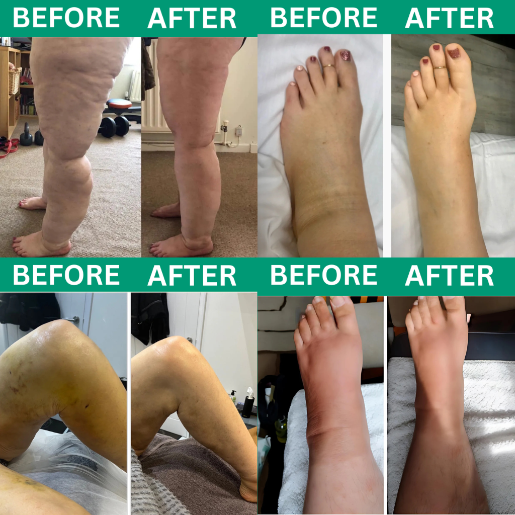 Oakwell™ 3-in-1 Leg Massager - Relief for Swelling & Poor Circulation Costenia®